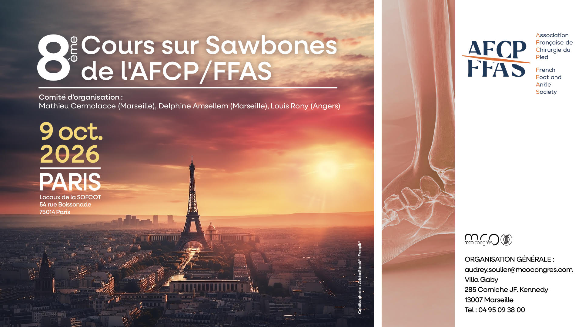Lire la suite à propos de l’article 8ème cours sur Sawbones de l’AFCP/FFAS